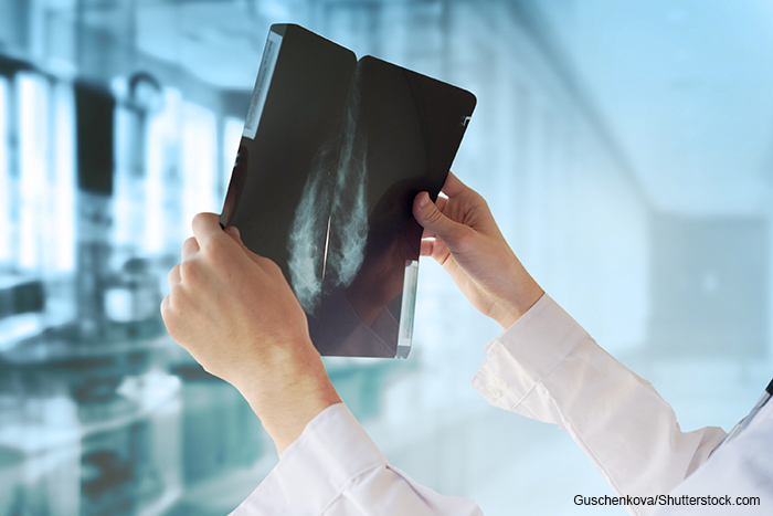 doctor holding mammogram